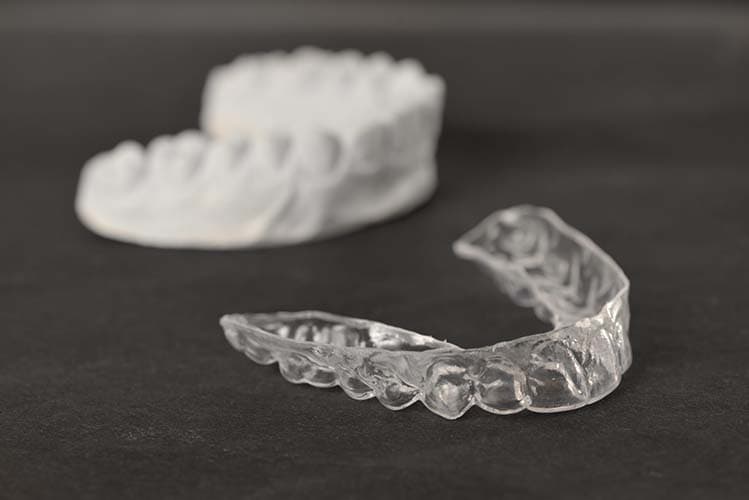 Invisalign Clear Aligners — photo representing this service at Hedgewood Dental, Woodbridge VA