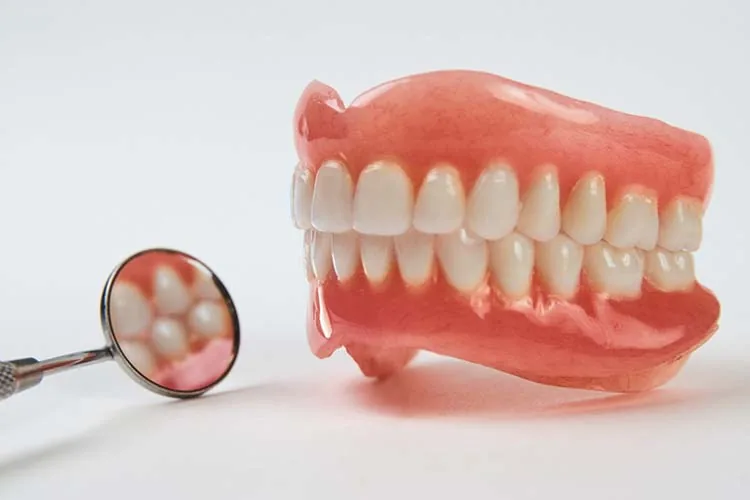 Implant-Supported Dentures (Overdentures) — photo representing this service at Hedgewood Dental, Woodbridge VA