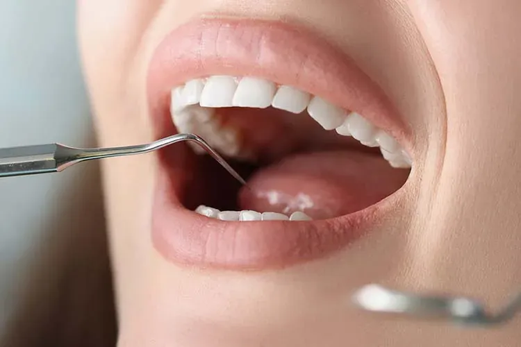 Featured image for the article: Periodontal Treatment Cost in Woodbridge, VA (2026 Guide)