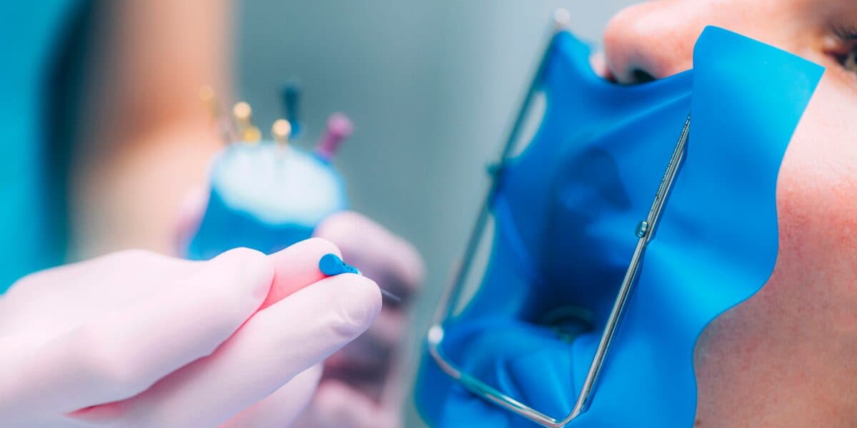 Featured image for the article: How Root Canal Treatment Can Save Your Tooth