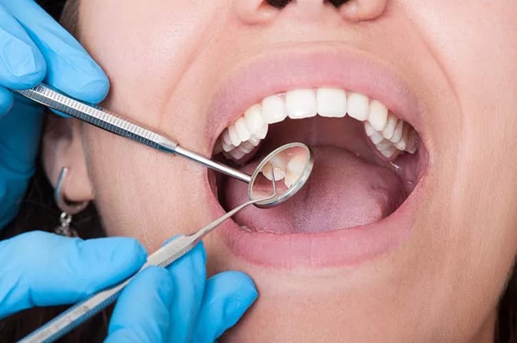 Featured image for the article: Wisdom Teeth Removal vs Tooth Extraction in Woodbridge, VA