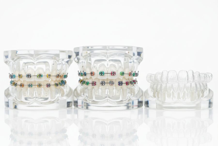 Types of kids braces options available in Woodbridge VA